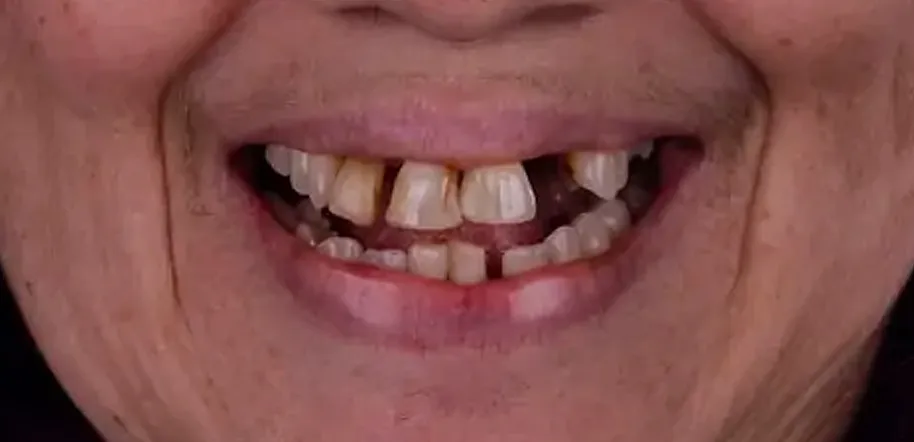 Caso Roberta — antes do tratamento