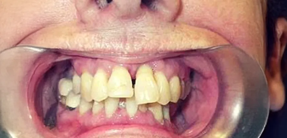 Caso Cláudia — antes do tratamento